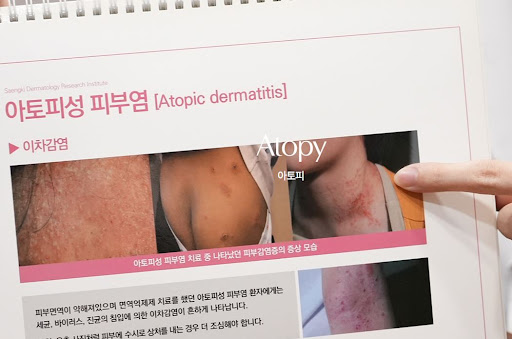 생기한의원 아토피 페이지, 진료 전 알아두면 좋은 기본 정보